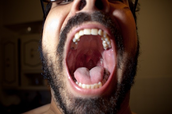 tonsils_1k